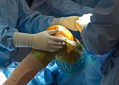 برترین جراح زانو در تهران کیست؟